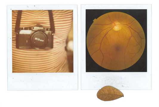 Eye See: Tracing the Tech